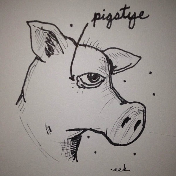 Pigstye